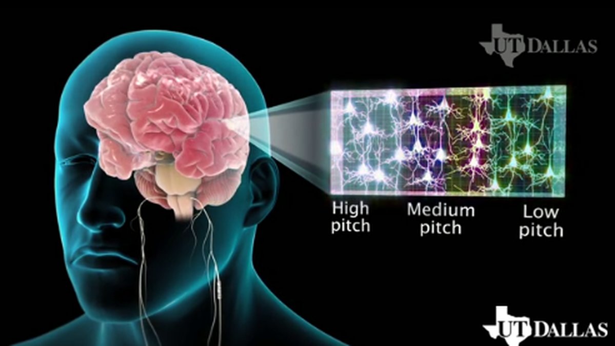 Den nya tekniken skickar elektriska impulser vilket påverkar hjärnan.
